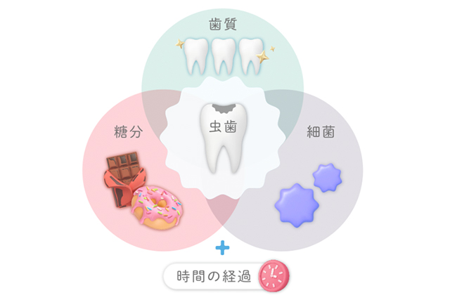 むし歯が起こりやすくなる原因