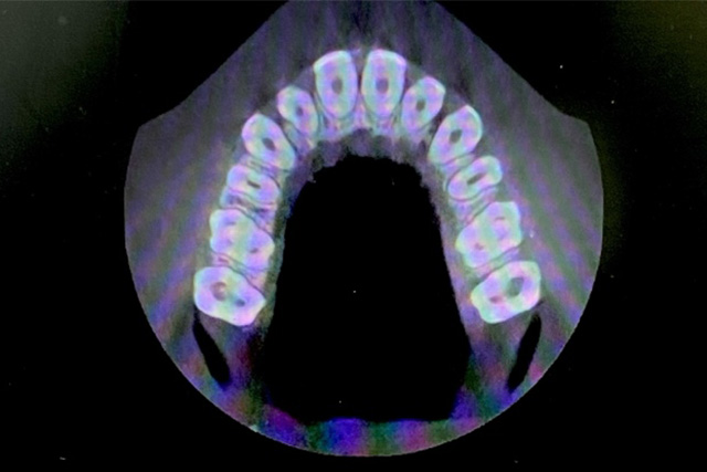 3DCT