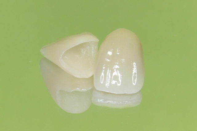 銀歯が気になる方必見！セラミック治療のメリットデメリットは？