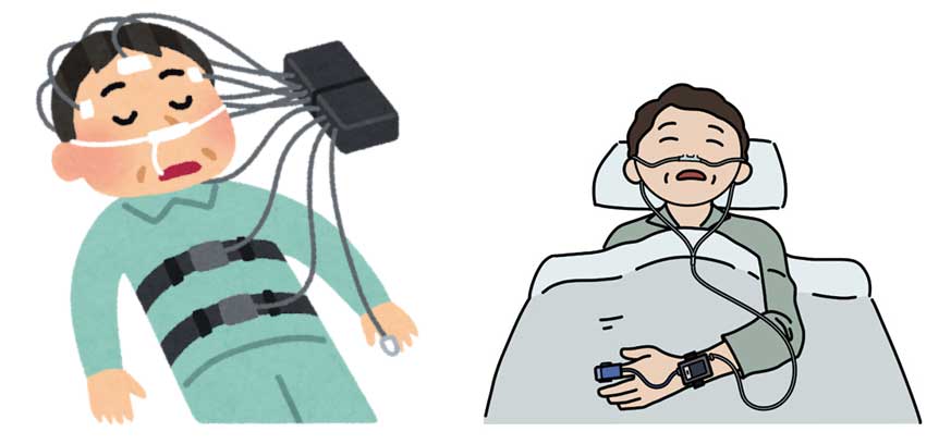 重症度の分類
