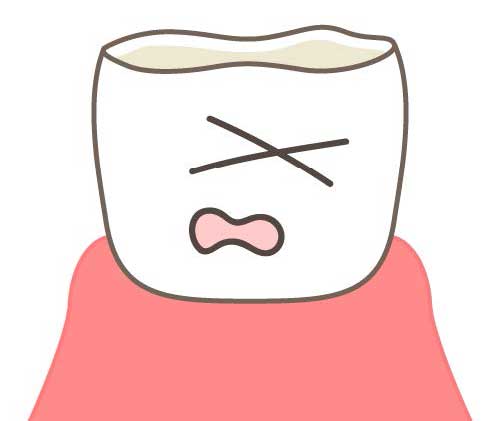 歯ぎしり