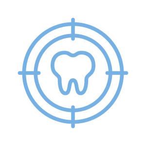 ダイレクトボンディング